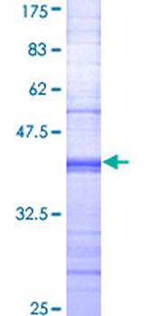 FCGR2A (Human) Recombinant Protein (Q01)
