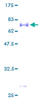FCER2 (Human) Recombinant Protein (P01)