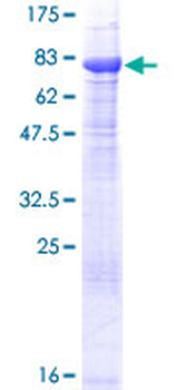 FANCC (Human) Recombinant Protein (P01)