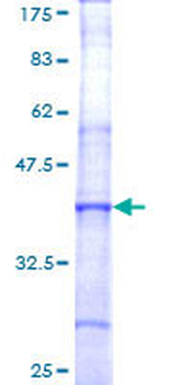 F5 (Human) Recombinant Protein (Q01)