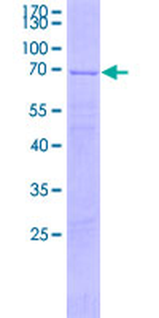 NR2F6 (Human) Recombinant Protein (P01)