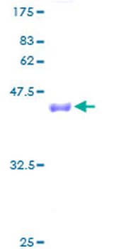 EIF4EBP2 (Human) Recombinant Protein (P01)