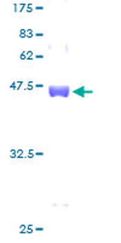 EIF1AX (Human) Recombinant Protein (P01)