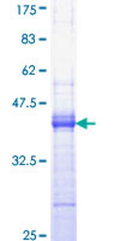 EGF (Human) Recombinant Protein (Q01)