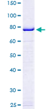 EEF1A1 (Human) Recombinant Protein (P02)