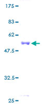 EDN3 (Human) Recombinant Protein (P01)