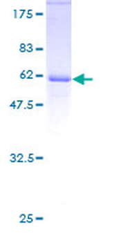 E2F6 (Human) Recombinant Protein (P01)
