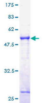 TOR1A (Human) Recombinant Protein (P01)