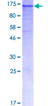 DSG1 (Human) Recombinant Protein (P01)