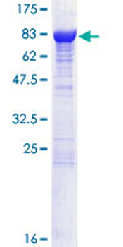 DPYSL2 (Human) Recombinant Protein (P01)