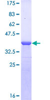DMP1 (Human) Recombinant Protein (Q01)