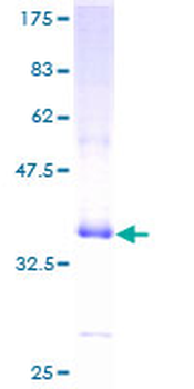 DEFA1 (Human) Recombinant Protein (P01)