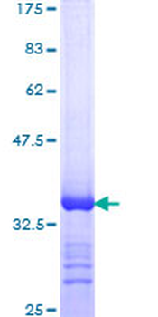 DHX9 (Human) Recombinant Protein (Q01)