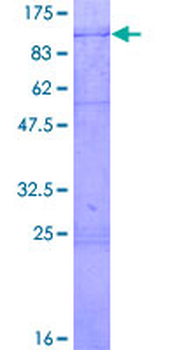 DDX3X (Human) Recombinant Protein (P01)