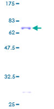 DCX (Human) Recombinant Protein (P01)