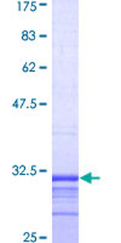 CYBB (Human) Recombinant Protein (Q01)
