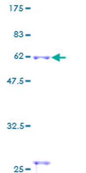 CTSS (Human) Recombinant Protein (P01)