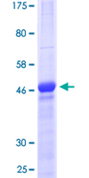 CTGF (Human) Recombinant Protein (P01)