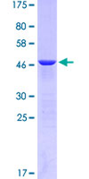 CTF1 (Human) Recombinant Protein (P01)