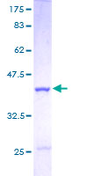 CSTB (Human) Recombinant Protein (P01)