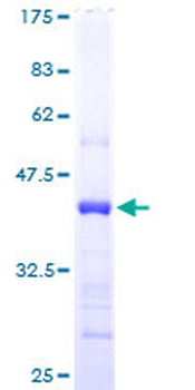 CST6 (Human) Recombinant Protein (P01)