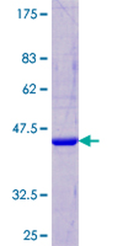 CST5 (Human) Recombinant Protein (P01)