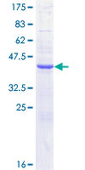 CST1 (Human) Recombinant Protein (P01)