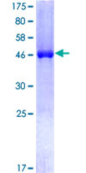 CSNK2B (Human) Recombinant Protein (P01)