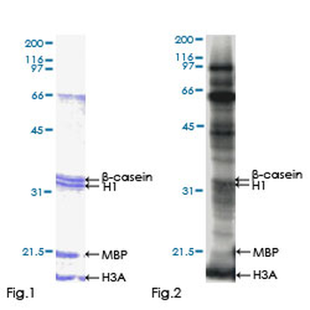 CSNK2A2 (Human) Recombinant Protein (P01)