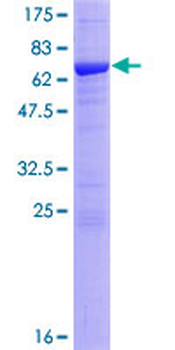 CSNK2A1 (Human) Recombinant Protein (P01)
