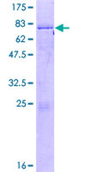 CSNK1E (Human) Recombinant Protein (P01)