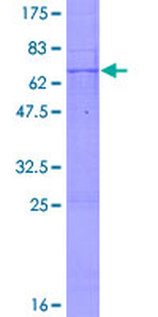 CSNK1A1 (Human) Recombinant Protein (P01)