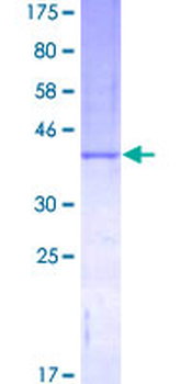 CSF2 (Human) Recombinant Protein (P01)