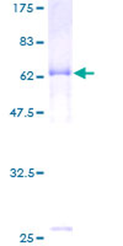 HAPLN1 (Human) Recombinant Protein (P01)
