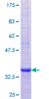 CRP (Human) Recombinant Protein (P01)