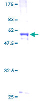 COL2A1 (Human) Recombinant Protein (P01)