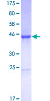 CNTF (Human) Recombinant Protein (P01)