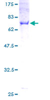 CNP (Human) Recombinant Protein (P01)