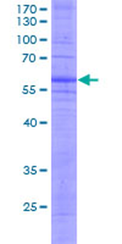 CCR8 (Human) Recombinant Protein (P01)