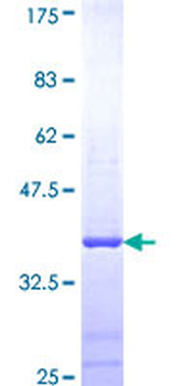 CLU (Human) Recombinant Protein (Q01)