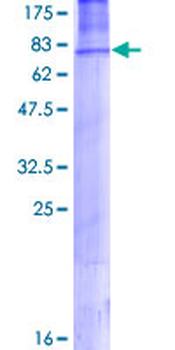 AP2M1 (Human) Recombinant Protein (P01)