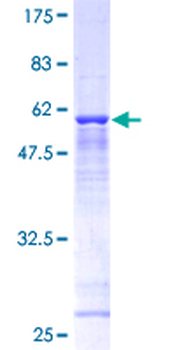 TBCB (Human) Recombinant Protein (P01)