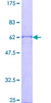CISH (Human) Recombinant Protein (P02)