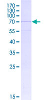 CHRNA1 (Human) Recombinant Protein (P01)