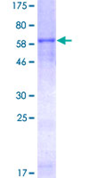 CHI3L1 (Human) Recombinant Protein (P01)