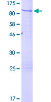 CHGA (Human) Recombinant Protein (P01)