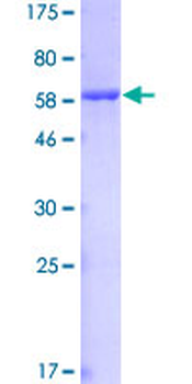 AKR1C4 (Human) Recombinant Protein (P01)