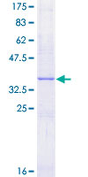 CGA (Human) Recombinant Protein (P01)