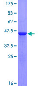 CFL2 (Human) Recombinant Protein (P01)