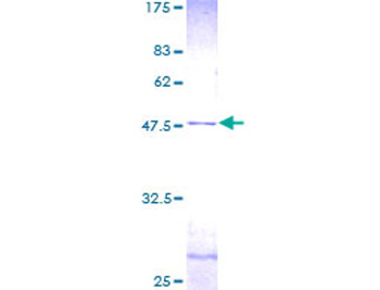 CETN2 (Human) Recombinant Protein (P01)